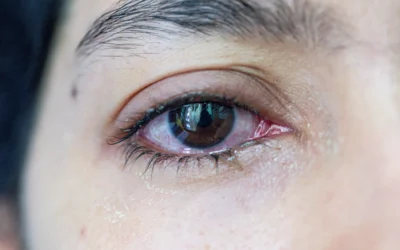 Watery Eyes, But They Feel Dry? Find Out Why This Happens